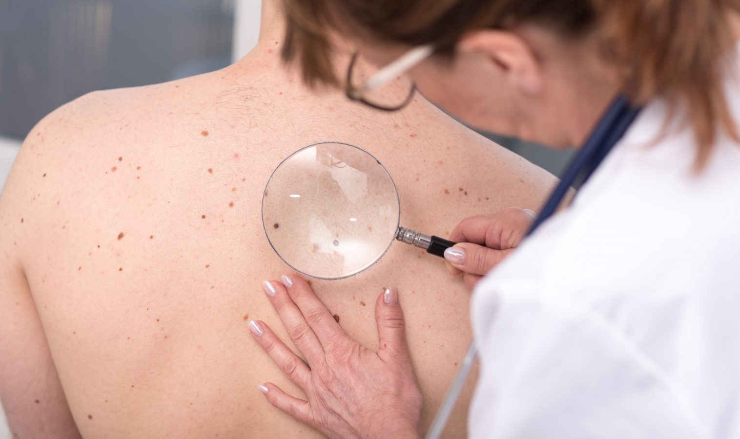 Skin Cancer Surgeries and Treatment